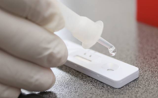 Eine Person benutzt einen Covid19-Test. Zu sehen ist ein Tropfer der Testflüssigkeit.