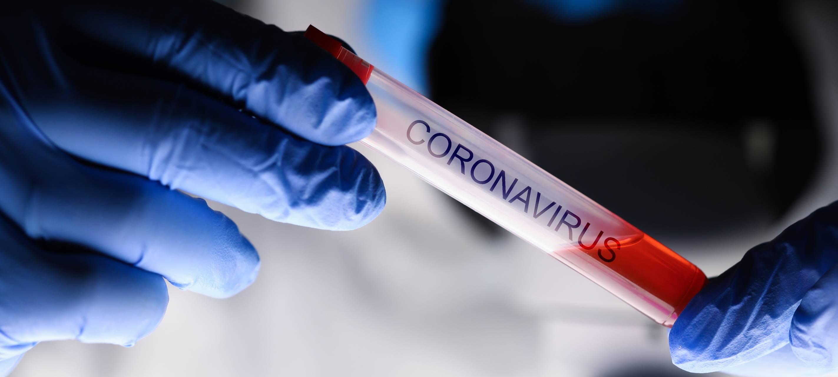 Erneut britische Virus-Variante in Düsseldorf nachgewiesen