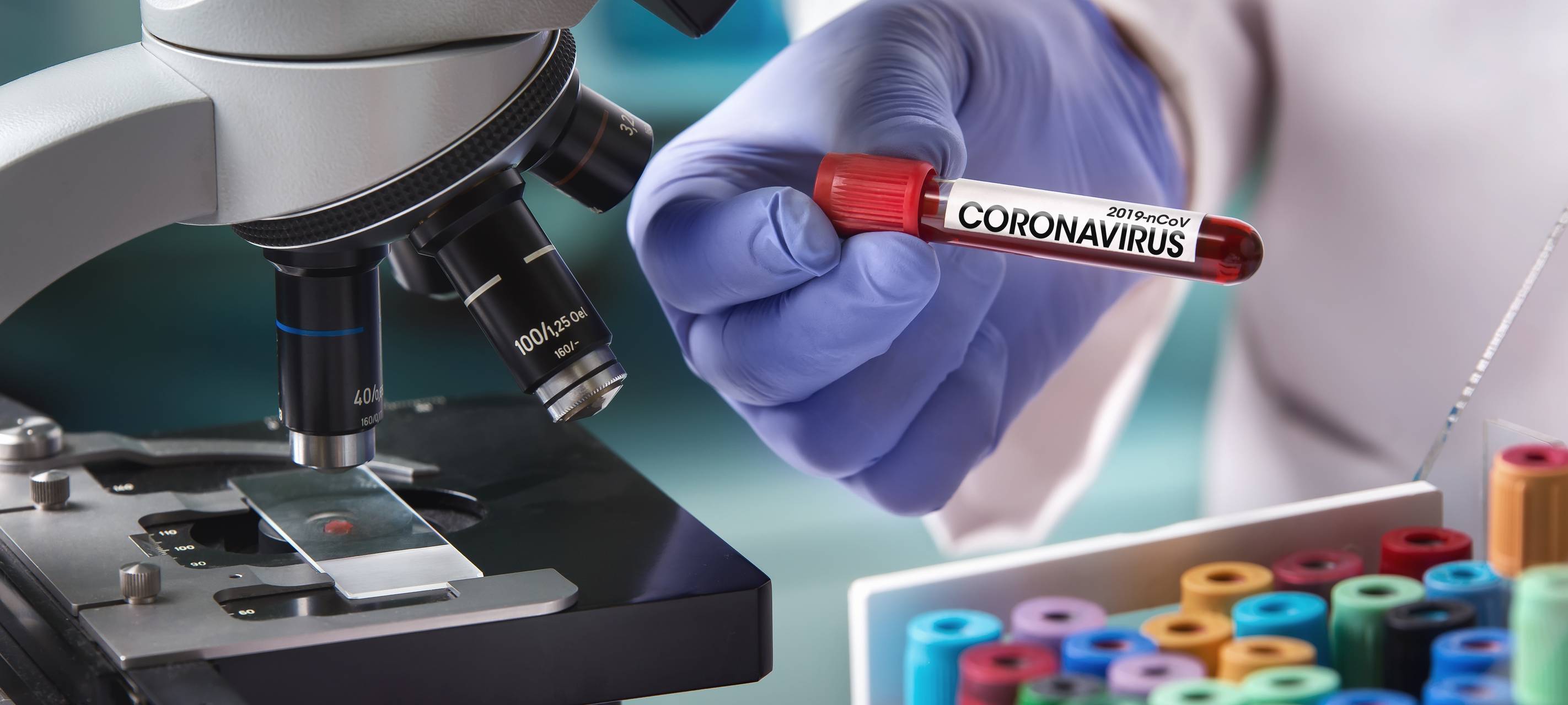 Düsseldorf: Corona-Zahlen bleiben auf hohem Niveau