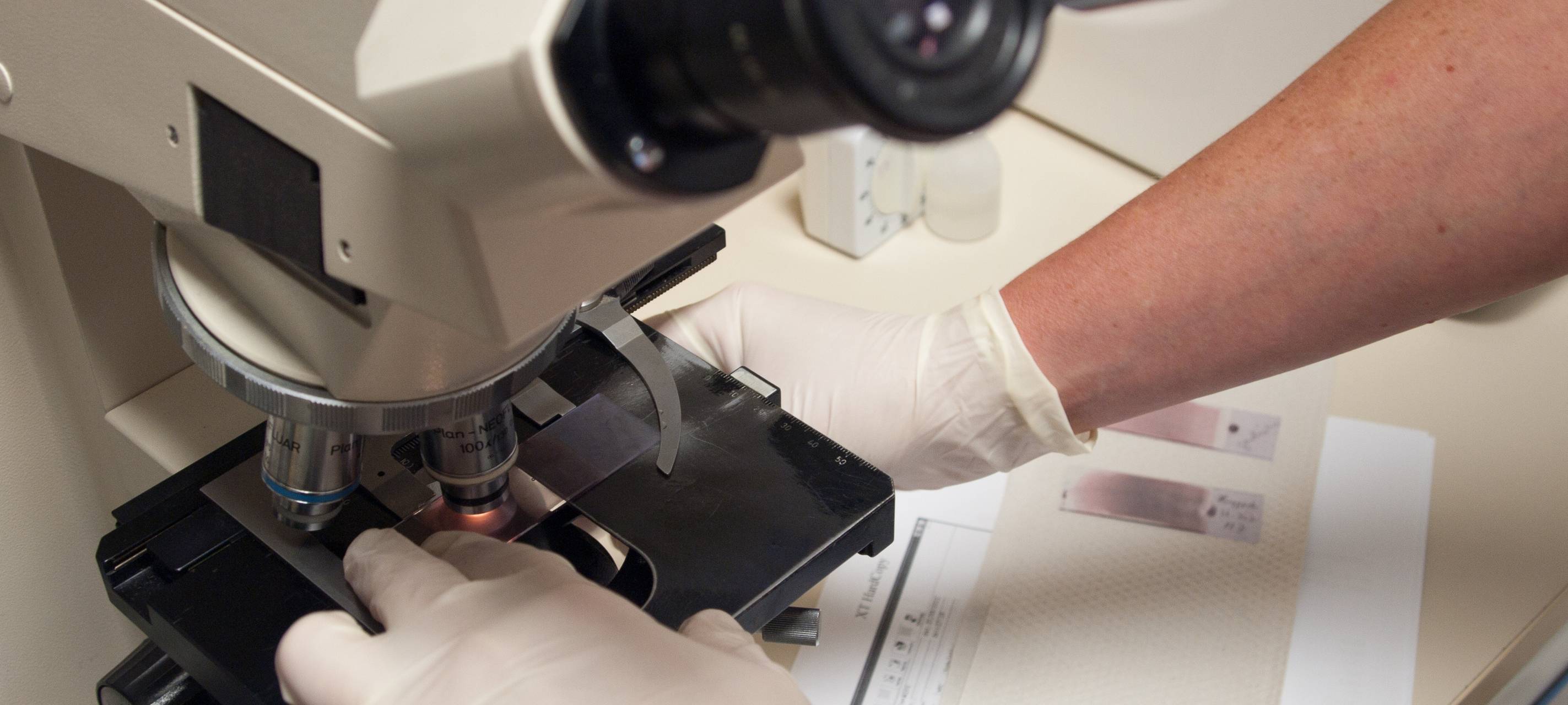 Impfung gegen Brustkrebs? So weit ist die Forschung